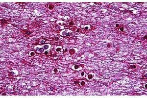 Human Brain, Cortex: Formalin-Fixed, Paraffin-Embedded (FFPE) (HMX2 Antikörper  (AA 125-224))
