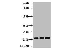 Western blot analysis of 1) MCF7, 2) Rat Kidney Tissue, 3) Mouse Brain Tissue, diluted at 1:2000. (Peroxiredoxin 1 Antikörper)