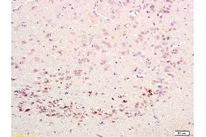 Formalin-fixed and paraffin embedded rat brain labeled with Rabbit Anti-CDK5 Polyclonal Antibody  at 1:200 followed by conjugation to the secondary antibody and DAB staining.