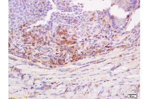 Formalin-fixed and paraffin embedded rat tongue labeled with Anti-Desmoglein 3/DSG3 Polyclonal Antibody, Unconjugated (ABIN718451) at 1:200 followed by conjugation to the secondary antibody (Desmoglein 3 Antikörper  (AA 50-75))