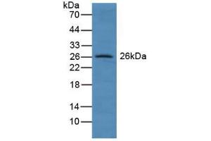 Figure. (GSTA4 Antikörper  (AA 3-222))