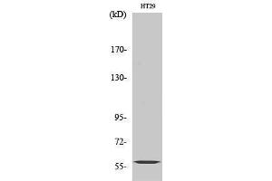 Western Blotting (WB) image for anti-Cytochrome P450, Family 2, Subfamily J, Polypeptide 2 (CYP2J2) (Internal Region) antibody (ABIN3184188) (CYP2J2 Antikörper  (Internal Region))