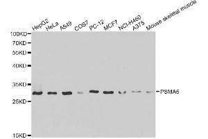 Western blot analysis of extracts of various cell lines, using PSMA6 antibody (ABIN6292835) at 1:1000 dilution. (PSMA6 Antikörper)