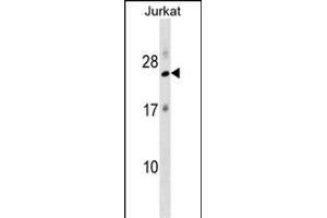RPL18 Antibody (N-term) (ABIN1538828 and ABIN2849097) western blot analysis in Jurkat cell line lysates (35 μg/lane). (RPL18 Antikörper  (N-Term))