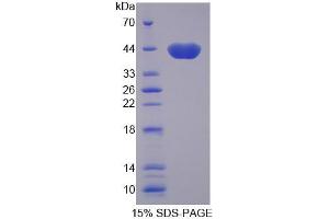 SDS-PAGE (SDS) image for Rhotekin (RTKN) (AA 309-416) protein (His tag,GST tag) (ABIN4989525) (Rhotekin Protein (RTKN) (AA 309-416) (His tag,GST tag))