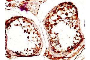 Immunohistochemistry (IHC) image for anti-C-Type Lectin Domain Family 4, Member E (CLEC4E) (AA 41-219) antibody (ABIN7146077)