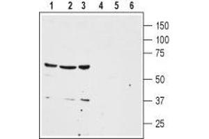Western blot analysis of human colon cancer HT-29 (lanes 1 and 4), human lung small cell carcinoma NCI-H526 (lanes 2 and 5) and human breast adenocarcinoma MDA-MB-468 (lanes 3 and 6) cell lysates: - 1-3. (NTSR1 Antikörper  (2nd Extracellular Loop))