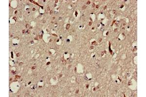 Immunohistochemistry of paraffin-embedded human brain tissue using ABIN7160025 at dilution of 1:100 (MAP3K13 Antikörper  (AA 506-835))