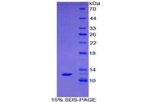 SDS-PAGE analysis of Rat Somatostatin Protein. (Somatostatin Protein (SST))