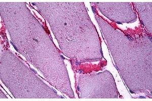 Human Skeletal Muscle, Interstitial Cells: Formalin-Fixed, Paraffin-Embedded (FFPE)