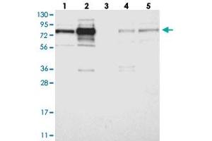 Western blot analysis of Lane 1: RT-4, Lane 2: U-251 MG, Lane 3: Human Plasma, Lane 4: Liver, Lane 5: Tonsil with GRAMD1C polyclonal antibody . (GRAMD1C Antikörper)