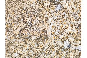 ABIN6261079 and ABIN6276536 at 1/100 staining Rat spleen tissue by IHC-P. (CTCF Antikörper  (C-Term))