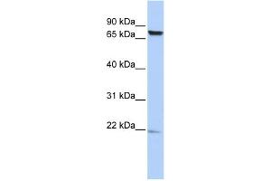 WB Suggested Anti-C7orf38 Antibody Titration: 0. (FAM200A Antikörper  (Middle Region))