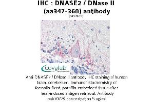 Image no. 2 for anti-Deoxyribonuclease II, Lysosomal (DNASE2) (AA 347-360) antibody (ABIN1733721)