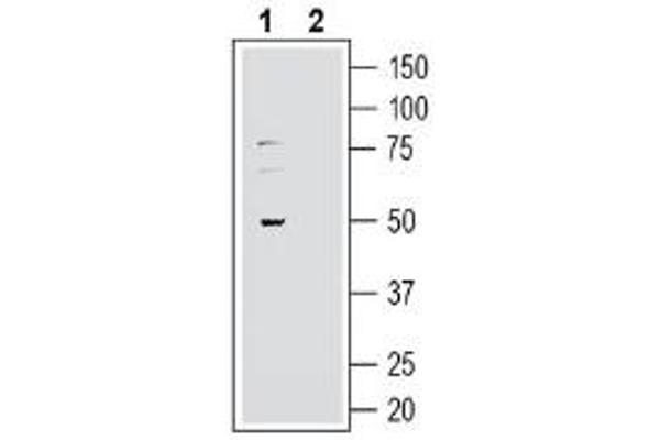 GPR37L1 Antikörper  (Extracellular, N-Term)