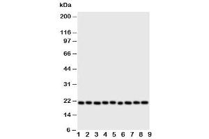 Western blot testing of Cytoglobin antibody and Lane 1:  rat brain (CYGB Antikörper  (N-Term))