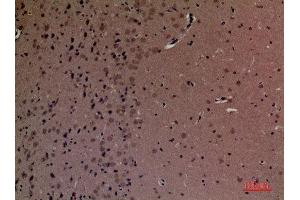 Immunohistochemistry (IHC) analysis of paraffin-embedded Mouse Brain, antibody was diluted at 1:100. (INPPL1 Antikörper  (Internal Region))