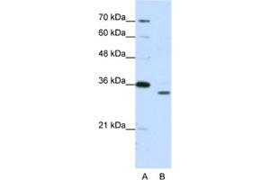 Western Blotting (WB) image for anti-Proteasome Subunit alpha Type 1 (PSMA1) antibody (ABIN2462129) (PSMA1 Antikörper)