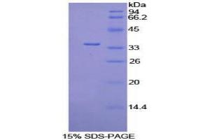 SDS-PAGE (SDS) image for Pyruvate Dehydrogenase Kinase, Isozyme 4 (PDK4) (AA 117-387) protein (His tag) (ABIN1878459) (PDK4 Protein (AA 117-387) (His tag))