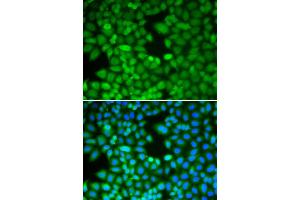 Immunofluorescence analysis of MCF-7 cell using RAN antibody. (RAN Antikörper  (AA 1-216))