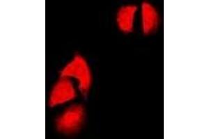 Immunofluorescent analysis of Cyclin D2 staining in SW480 cells. (Cyclin D2 Antikörper)