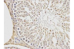 Immunohistochemistry (IHC) image for anti-Placenta Growth Factor (PGF) antibody (ABIN1874109) (PLGF Antikörper)