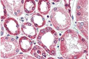 Immunohistochemistry (Paraffin-embedded Sections) (IHC (p)) image for anti-Beclin 1, Autophagy Related (BECN1) (C-Term) antibody (ABIN461894)