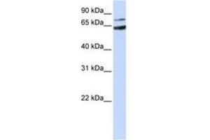 Image no. 1 for anti-Frizzled Family Receptor 8 (FZD8) (AA 144-193) antibody (ABIN6743056) (FZD8 Antikörper  (AA 144-193))