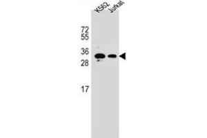 Western blot analysis of HOXA6 / HOX1B Antibody (Center) in K562, Jurkat cell line lysates (35ug/lane). (HOXA6 Antikörper  (Middle Region))