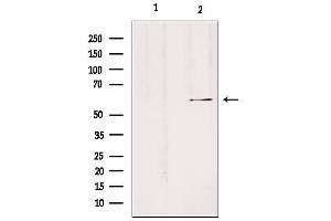 Western blot analysis of extracts from Hela, using SLC24A3 Antibody.