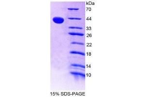 SDS-PAGE (SDS) image for Tachykinin 3 (TAC3) (AA 29-101) protein (His tag,GST tag) (ABIN2123372) (Tachykinin 3 Protein (TAC3) (AA 29-101) (His tag,GST tag))