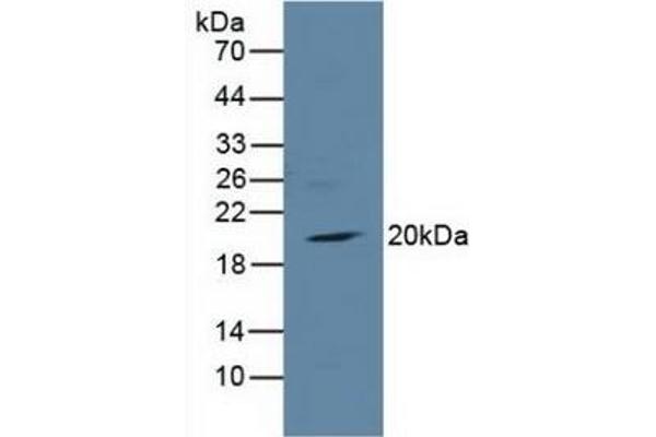 TIRAP Antikörper  (AA 1-221)