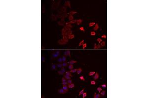 Immunofluorescence analysis of MCF7 cells using P2RX4 antibody (ABIN6132449, ABIN6145115, ABIN6145116 and ABIN6222387). (P2RX4 Antikörper  (AA 55-338))