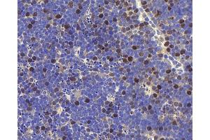 Immunohistochemistry analysis of paraffin-embedded mouse thymus using RACGAP1 Polyclonal Antibody at dilution of 1:400. (RACGAP1 Antikörper)