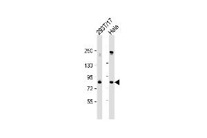 All lanes : Anti-SNK Antibody  at 1:1000 dilution Lane 1: 293T/17 whole cell lysate Lane 2: Hela whole cell lysate Lysates/proteins at 20 μg per lane. (PLK2 Antikörper  (C-Term))