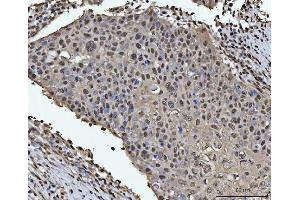 IHC analysis of HOXC4 using anti-HOXC4 antibody (ABIN7603059). (HOXC4 Antikörper  (Middle Region))