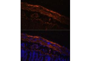 Immunofluorescence (IF) image for anti-Myosin Regulatory Light Polypeptide 9 (MYL9) (AA 1-100) antibody (ABIN3023463)