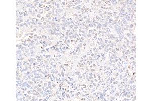 Immunohistochemistry (IHC) image for anti-Structural Maintenance of Chromosomes 3 (SMC3) (C-Term) antibody (ABIN7453572) (SMC3 Antikörper  (C-Term))