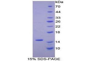 SDS-PAGE analysis of Human Numb Homolog Protein.