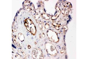 Anti-CD31 antibody, IHC(P): Human Placenta Tissue (CD31 Antikörper  (C-Term))