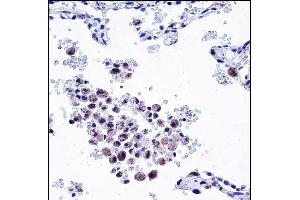 ARHGDIB Antibody (C-term) (ABIN657665 and ABIN2846658) immunohistochemistry analysis in formalin fixed and paraffin embedded human lung tissue followed by peroxidase conjugation of the secondary antibody and DAB staining.