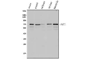 Western blot analysis of POT1 using anti-POT1 antibody (ABIN7600116).