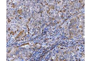 IHC analysis of STBD1 using anti-STBD1 antibody (ABIN7601576). (STBD1 Antikörper  (AA 39-328))