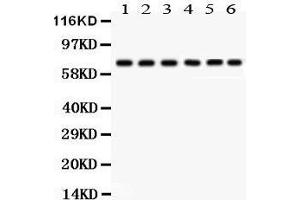 nti- PKC delta antibody, Western blotting All lanes: Anti PKC delta  at 0. (PKC delta Antikörper  (AA 1-160))