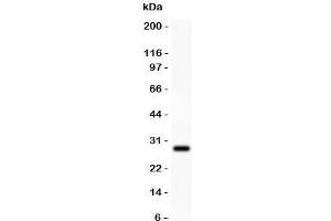 Western Blotting (WB) image for anti-Amyloid beta (A4) Precursor Protein (APP) (C-Term) antibody (ABIN3029934)