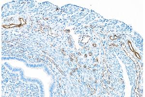 Immunohistochemistry (IHC) image for anti-Platelet/endothelial Cell Adhesion Molecule (PECAM1) (AA 1-50) antibody (ABIN7449414)