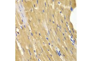 Immunohistochemistry of paraffin-embedded mouse heart using  antibody (ABIN3021755, ABIN3021756, ABIN3021757 and ABIN6215776) at dilution of 1:100 (40x lens). (Adenylate Kinase 1 Antikörper  (AA 1-194))
