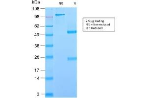SDS-PAGE Analysis Purified GP2 Recombinant Rabbit Monoclonal Antibody (GP2/2569R).