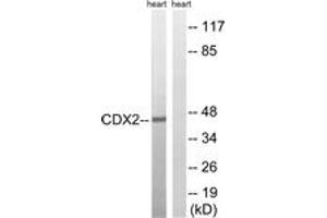 Western Blotting (WB) image for anti-Caudal Type Homeobox 2 (CDX2) (AA 249-298) antibody (ABIN1533159)