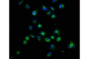 Immunofluorescence staining of Hela cells with ABIN7165221 at 1:22, counter-stained with DAPI. (CRB1 Antikörper  (AA 20-200))